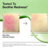 Anua Azelaic Acid 10 Hyaluron Redness Soothing Serum 30ml